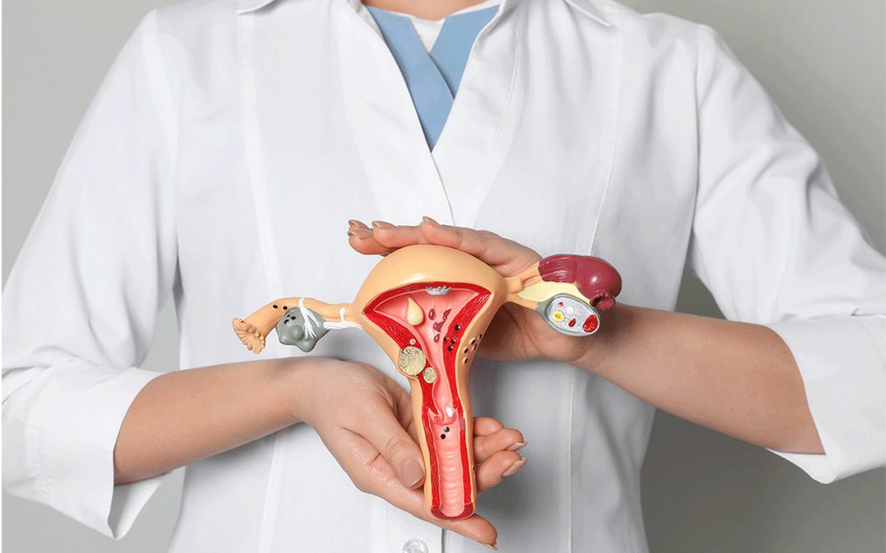 Consulta de oncologia clínica para tumores ginecológicos